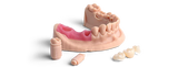 Gingival Mask Resin