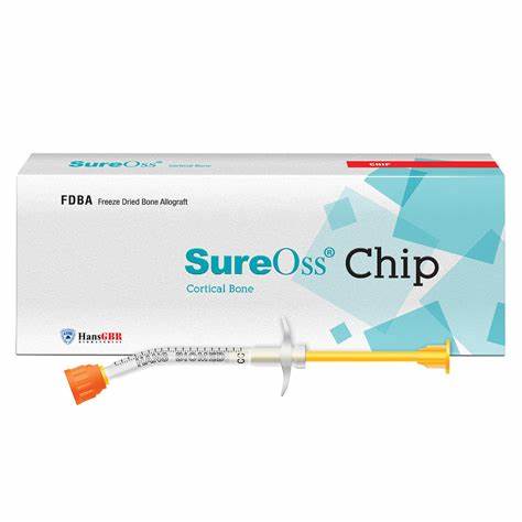 ORAL SURGERY - BONE GRAFTING (SUREOSS CHIP)