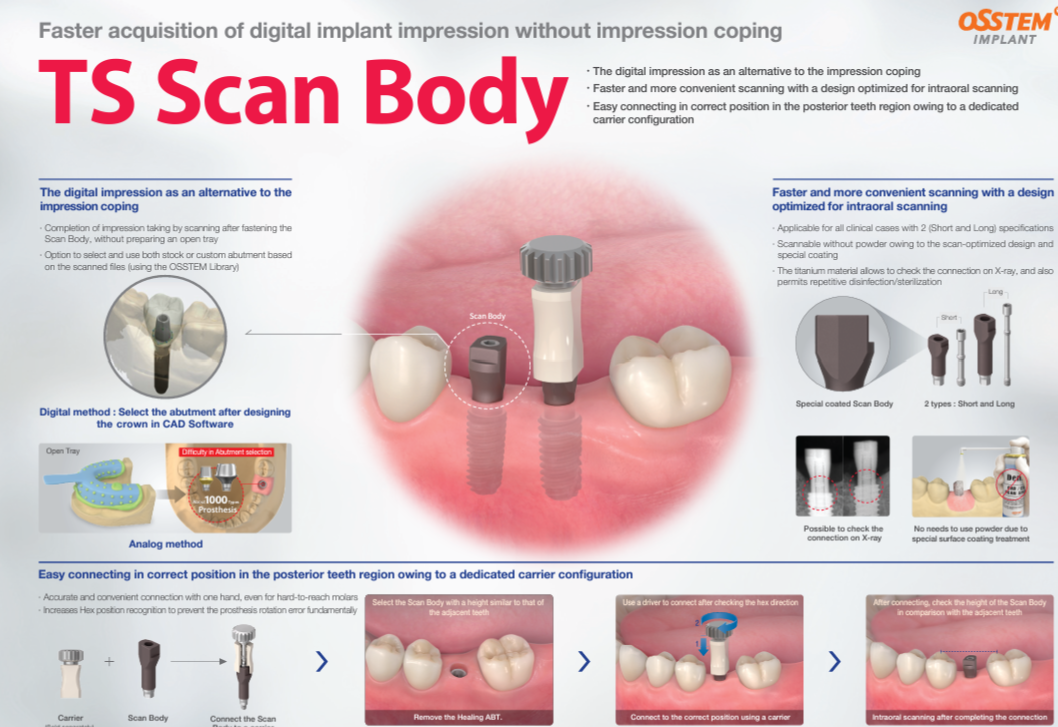 IMPLANT - SCAN BODY (OSSTEM TS) – D.R SUPPLY CO.