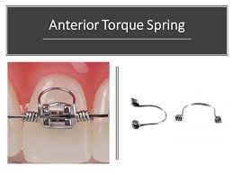 ORTHODONTIC - ANTERIOR TORQUE SPRING